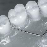 Sonda centrata 9-17C